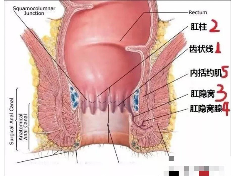 肛周脓肿