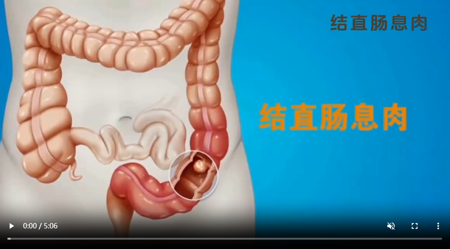 结直肠息肉